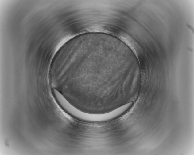 X0000098151141200805081036