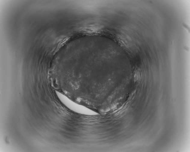 X0000098151156200805081036