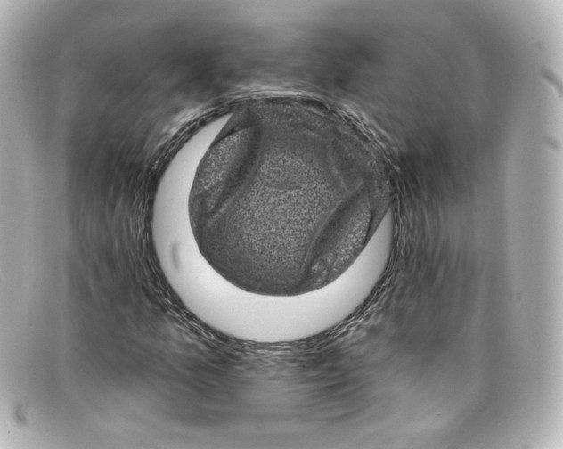 X0000098151157200805081036