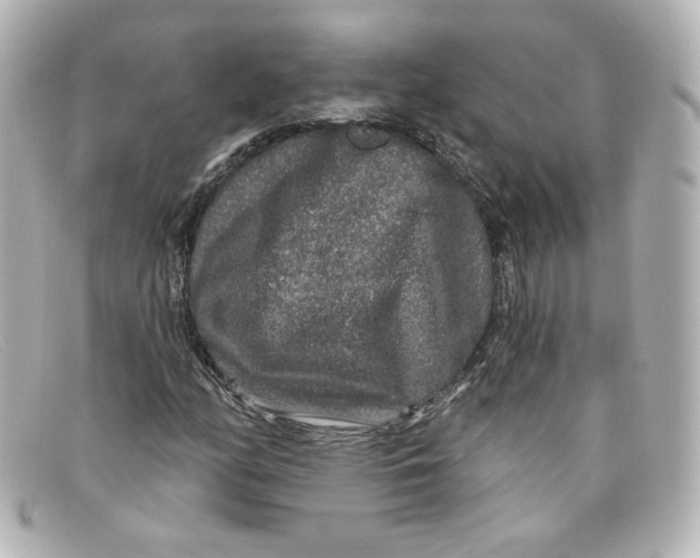 X0000098151158200805081036