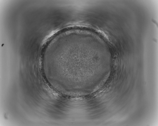X0000098151159200805081035
