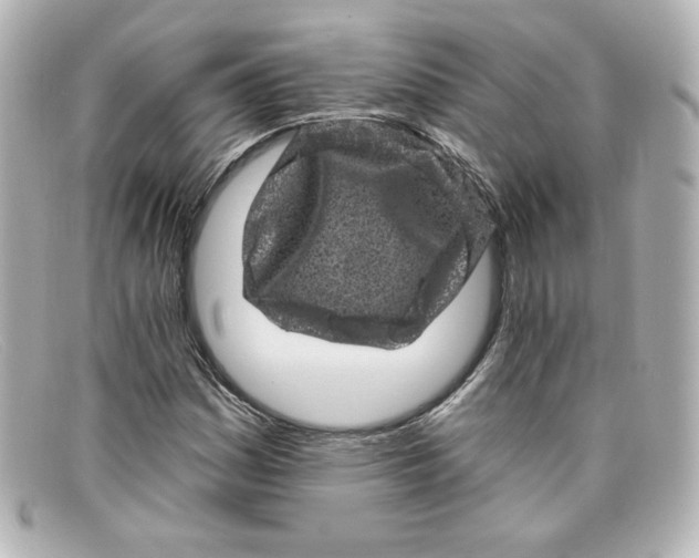 X0000098151161200805081035
