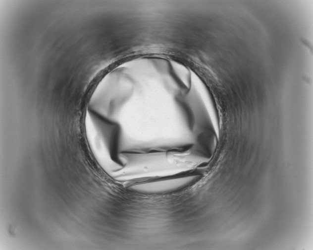 X0000098151166200805081035