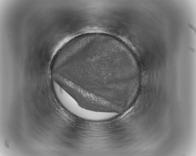 X0000098151167200805081035
