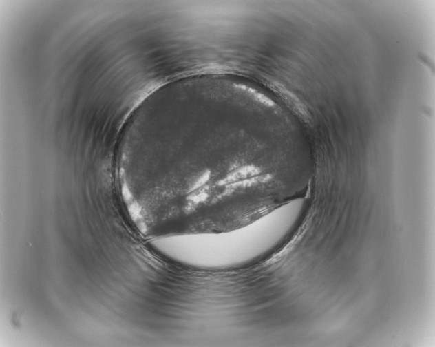 X0000098151170200805081035