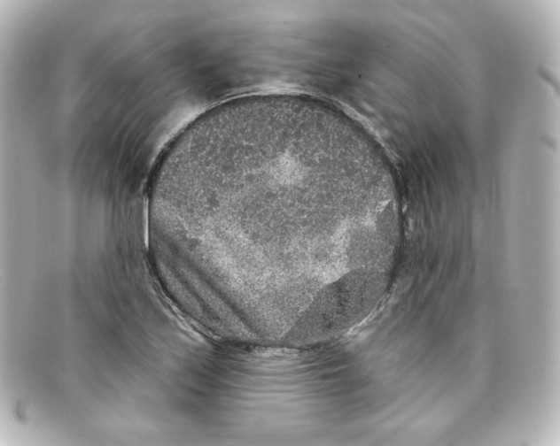 X0000098151171200805081035