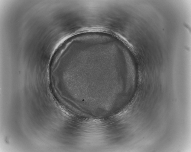 X0000098151174200805081035