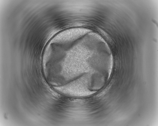 X0000098151178200805081035