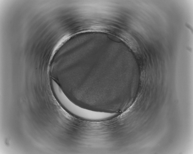 X0000098151180200805081035
