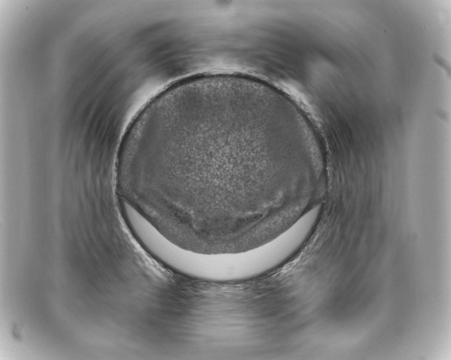 X0000098151183200805081035