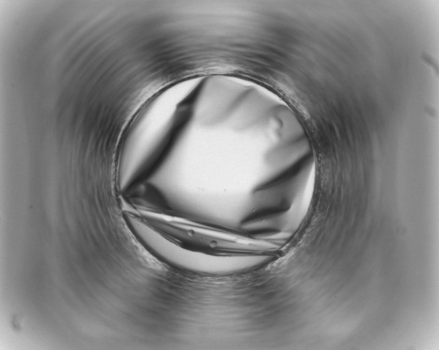X0000098151186200805081035