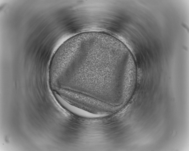 X0000098151187200805081035