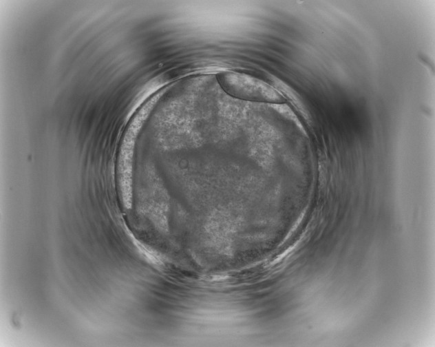 X0000098151194200805081035