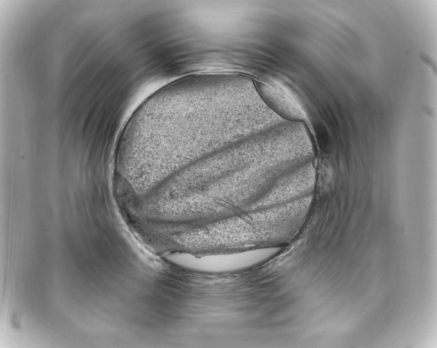 X0000098151195200805081035