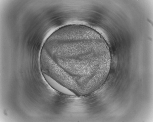X0000098151199200805081035