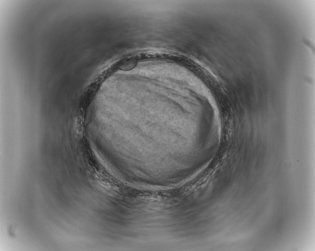 X0000098151207200805081034
