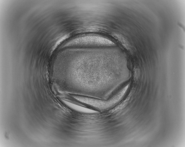 X0000098151210200805081034