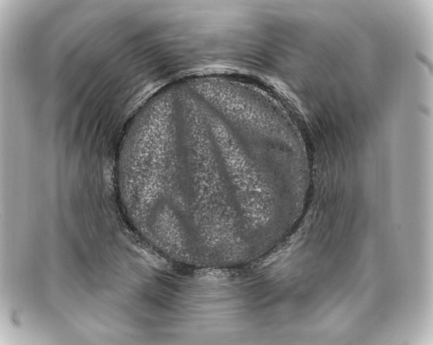X0000098151217200805081034