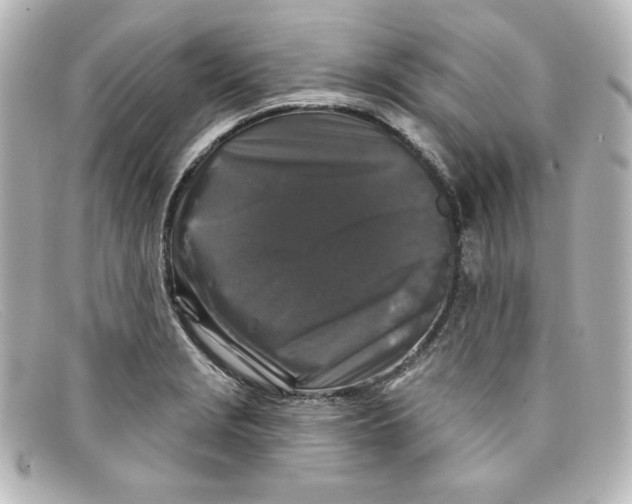 X0000098151229200805081035