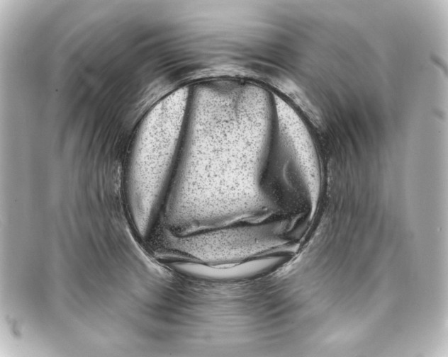 X0000098151233200805081035