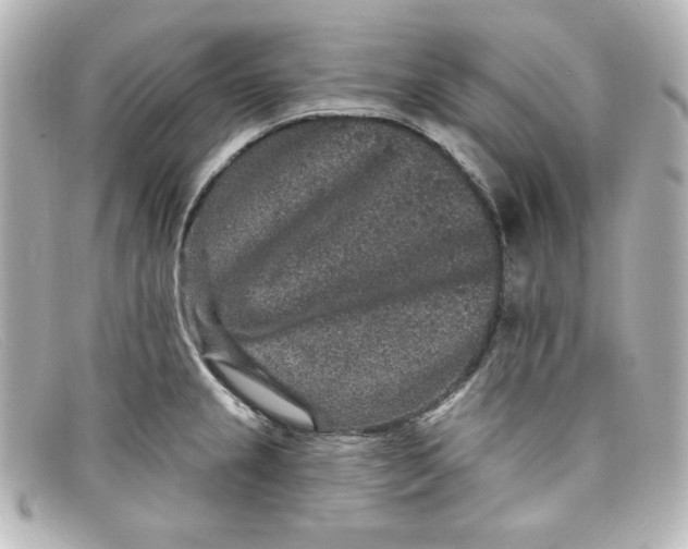 X0000098151237200805081035