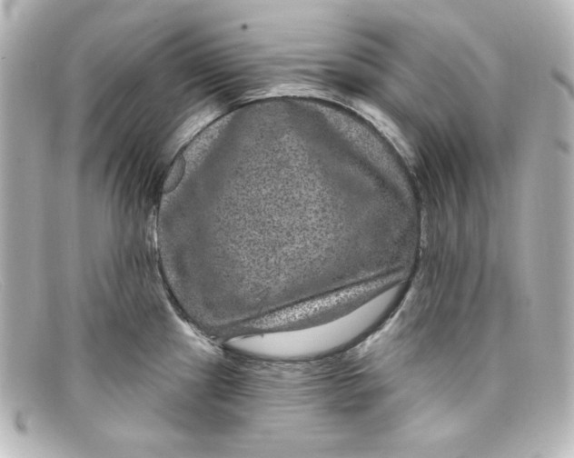 X0000098151241200805081035