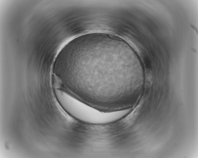 X0000098151246200805081035