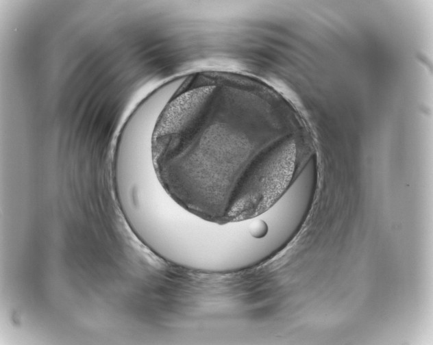 X0000098151248200805081035