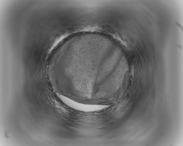 X0000098151256200805081034
