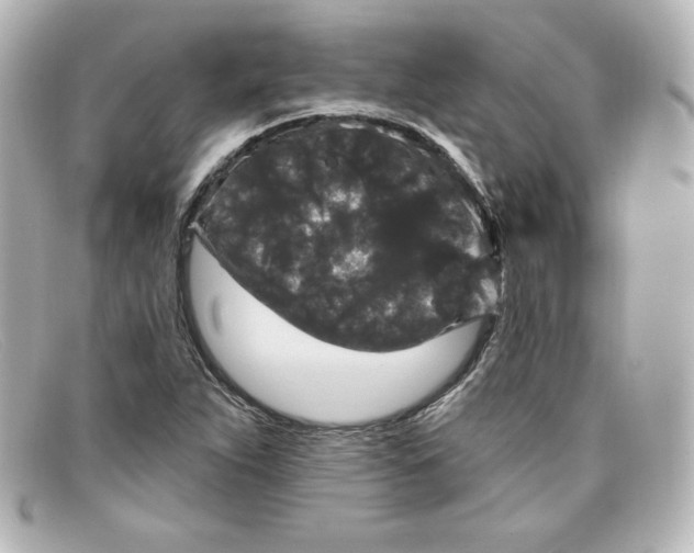 X0000098151263200805081034