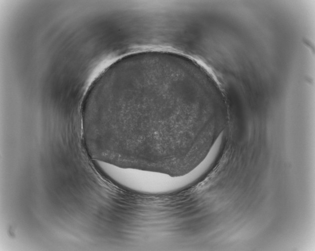 X0000098151271200805081034