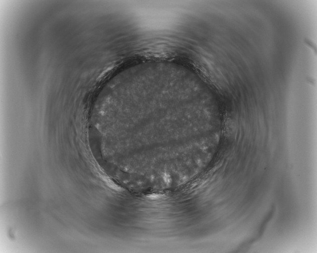 X0000098151297200805081033