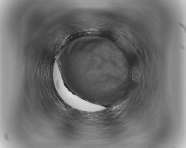 X0000098151298200805081033