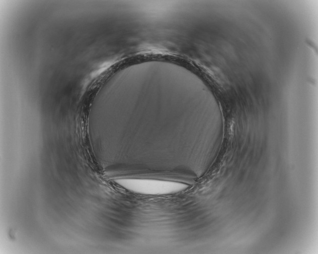 X0000098151303200805081033