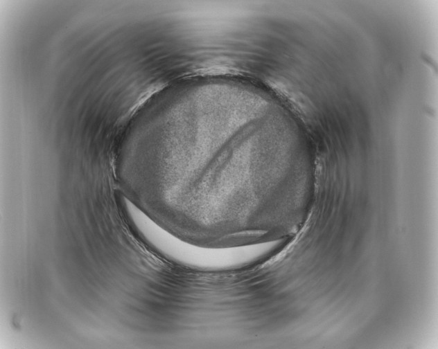 X0000098151305200805081033