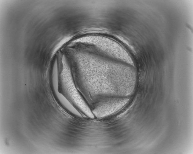 X0000098151317200805081033