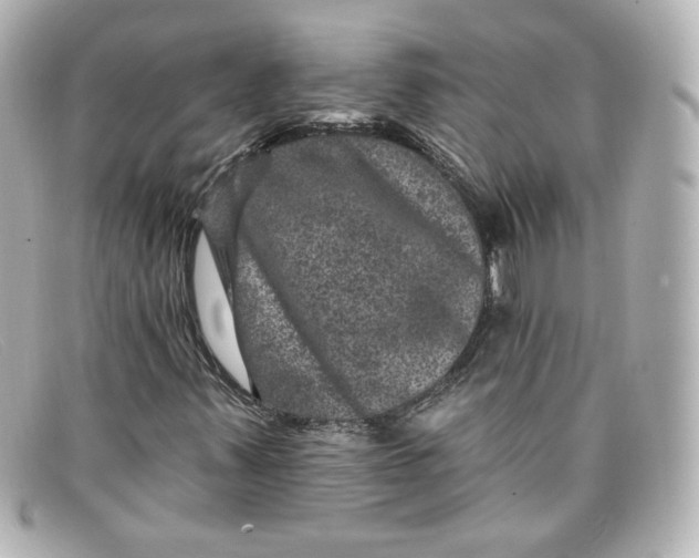 X0000098151347200805081033