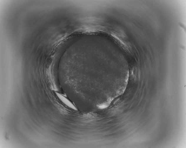 X0000098151348200805081033