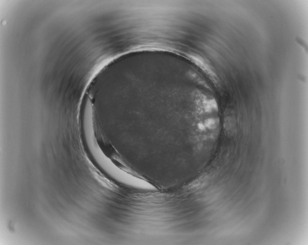 X0000098151372200805081032