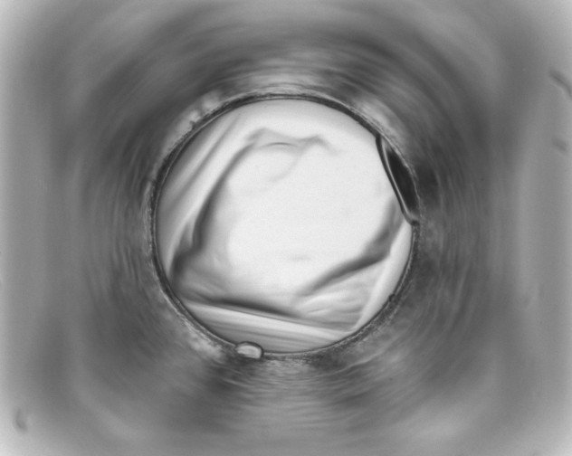 X0000098151384200805081032