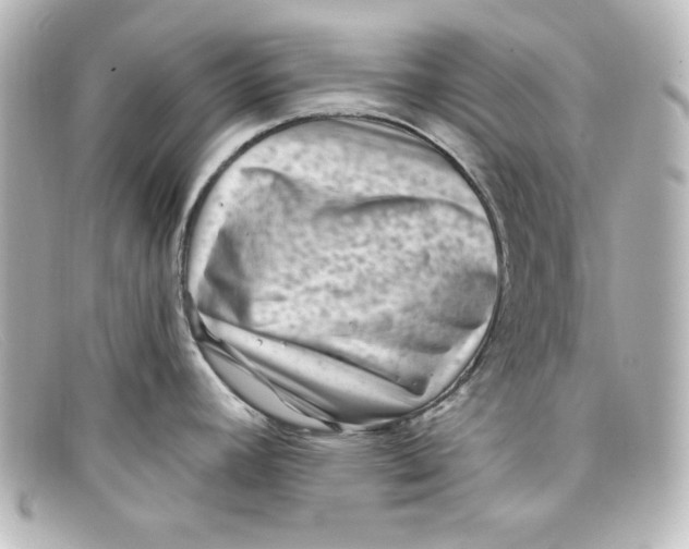 X0000098151392200805081032