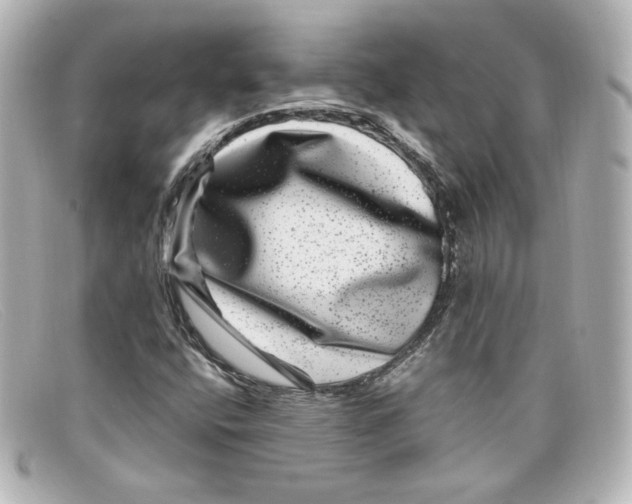X0000098151400200805081032