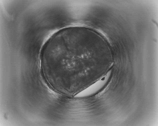 X0000098151414200805081032