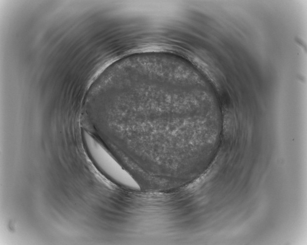 X0000098151417200805081032