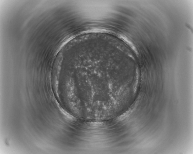 X0000098151425200805081032