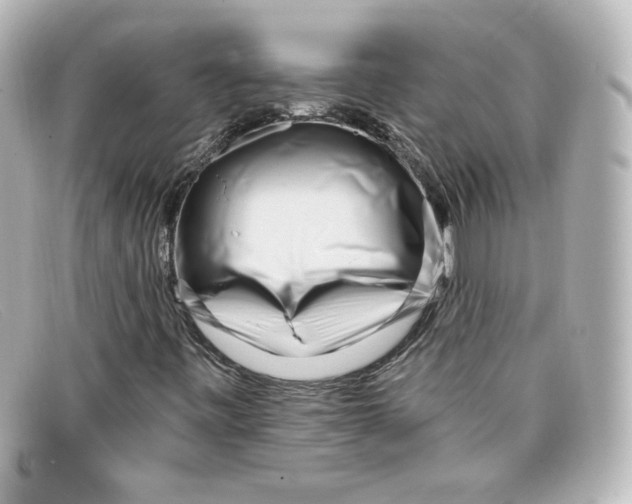 X0000098151443200805081031