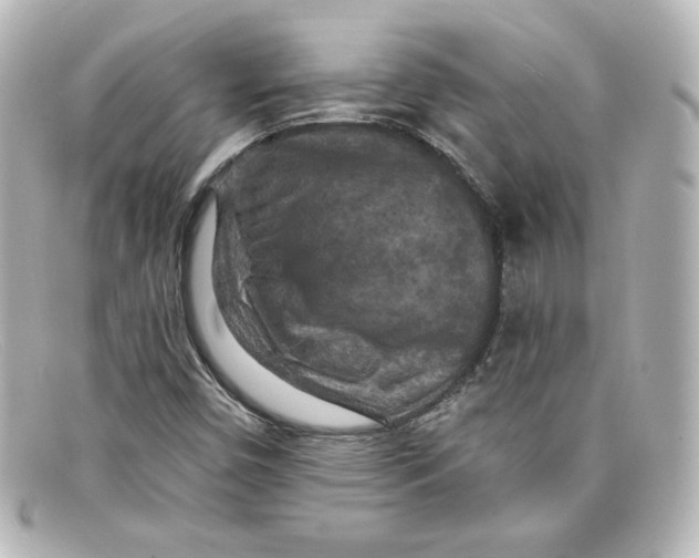 X0000098151450200805081031