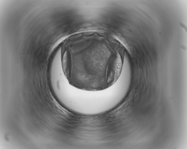 X0000098151452200805081031
