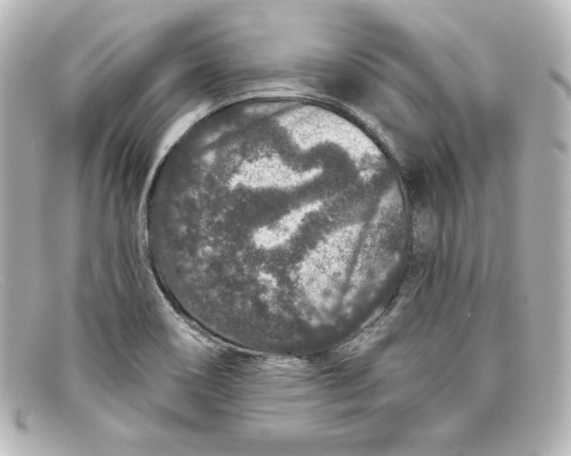 X0000098151466200805081031