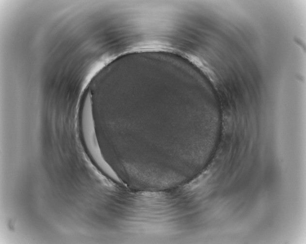 X0000098151469200805081031